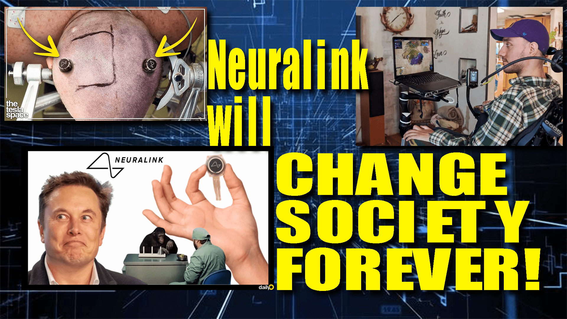 Neuralink Elon musk human trials will change society forever